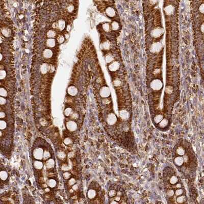 Immunohistochemistry-Paraffin: SDHB Antibody [NBP1-87069]