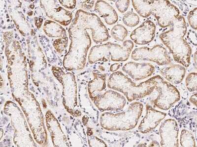 Immunohistochemistry-Paraffin: SDHB Antibody [NBP2-99066]