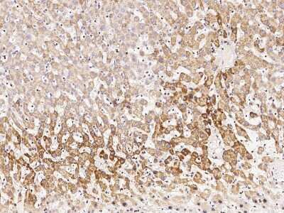 Immunohistochemistry-Paraffin: SDHB Antibody [NBP2-99066]