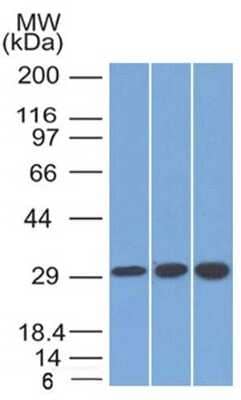 Western Blot: SDHB Antibody (SDHB/2126)Azide and BSA Free [NBP3-08809]