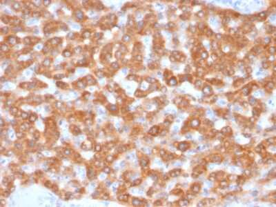 Immunohistochemistry-Paraffin: SDHB Antibody (SDHB/2126) [NBP3-07786]