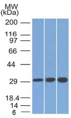 Western Blot: SDHB Antibody (SDHB/2126) [NBP3-07786]