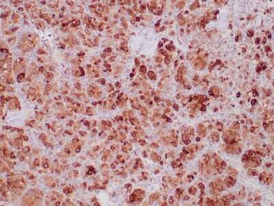 Immunohistochemistry-Paraffin: SDHB Antibody (SDHB/6697R) - Azide and BSA Free [NBP3-08827]