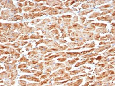 Immunohistochemistry-Paraffin: SDHB Antibody (SDHB/6697R) - Azide and BSA Free [NBP3-08827]