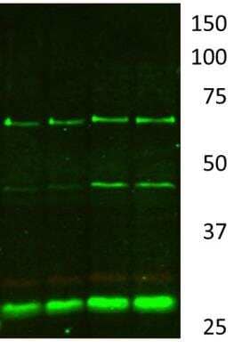 Western Blot: SDHB AntibodyBSA Free [NBP1-54154]