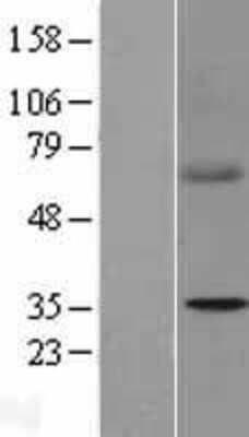 Western Blot: SDHB Overexpression Lysate [NBL1-15766]