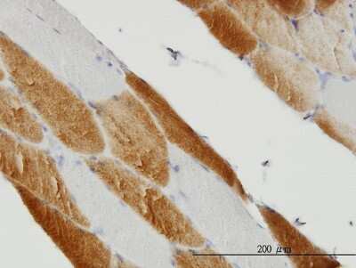 Immunohistochemistry-Paraffin: SDHC Antibody (3E2) [H00006391-M01]