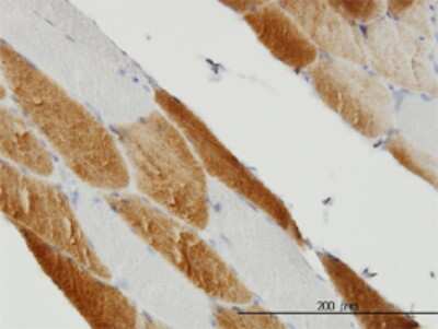 Immunohistochemistry-Paraffin: SDHC Antibody (3E2) [H00006391-M01]