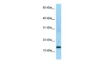 Western Blot: SDHC Antibody [NBP2-86795]