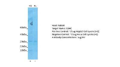Western Blot: SDHC Antibody [NBP2-86795]