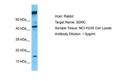 Western Blot: SDHC Antibody [NBP2-86796]