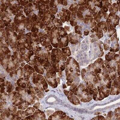 Immunohistochemistry-Paraffin: SDHD Antibody [NBP1-92372]