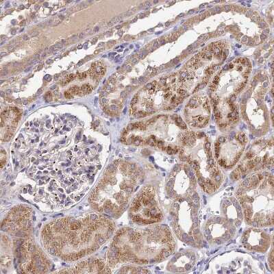 Immunohistochemistry-Paraffin: SDHD Antibody [NBP1-92372]