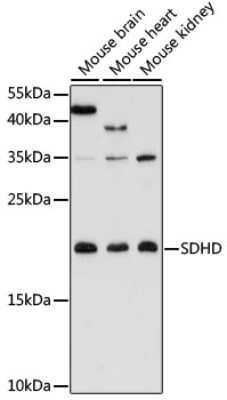 Western Blot: SDHD AntibodyAzide and BSA Free [NBP2-93065]