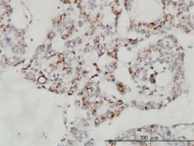 Immunohistochemistry-Paraffin: SDNSF/MCFD2 Antibody (3A5-G4) [H00090411-M01]