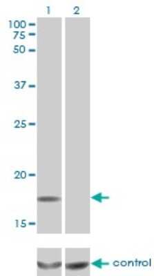 Western Blot: SDNSF/MCFD2 Antibody (3A5-G4) [H00090411-M01]