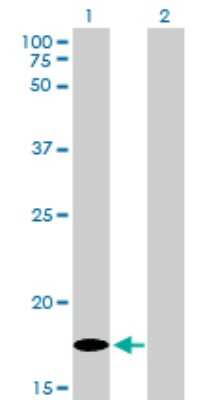 Western Blot: SDNSF/MCFD2 Antibody (3A5-G4) [H00090411-M01]