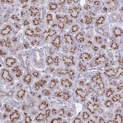 Immunohistochemistry: SDNSF/MCFD2 Antibody [NBP2-37873]