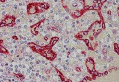 Immunohistochemistry: SDPR Antibody [NBP1-44090]