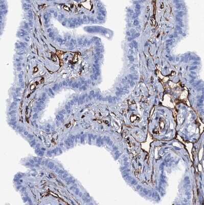Immunohistochemistry-Paraffin: SDPR Antibody [NBP1-86610]