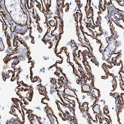 Immunohistochemistry-Paraffin: SDPR Antibody [NBP1-86610]