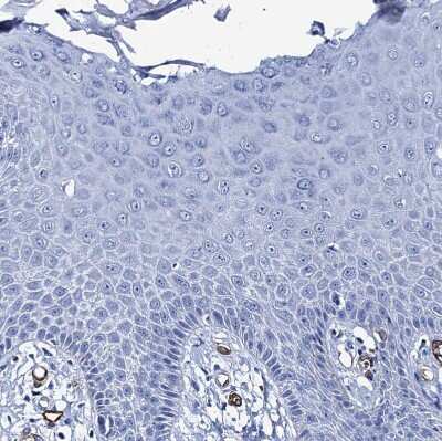 Immunohistochemistry-Paraffin: SDPR Antibody [NBP1-86610]