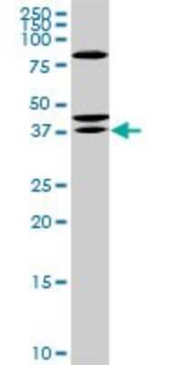 Western Blot: SDR16C5 Antibody (3G8) [H00195814-M01]