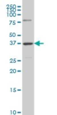 Western Blot: SDR16C5 Antibody (3G8) [H00195814-M01]