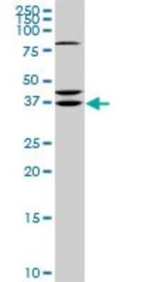 Western Blot: SDR16C5 Antibody (3G8) [H00195814-M01]