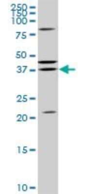 Western Blot: SDR16C5 Antibody (3G8) [H00195814-M01]