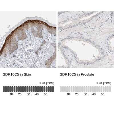 Immunohistochemistry-Paraffin: SDR16C5 Antibody [NBP1-87150]