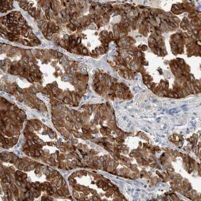 Immunohistochemistry-Paraffin: SDR16C5 Antibody [NBP1-87150]