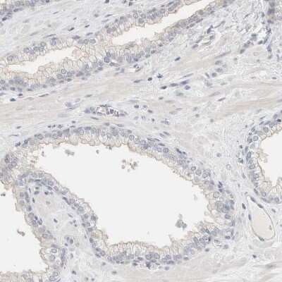Immunohistochemistry-Paraffin: SDR16C5 Antibody [NBP1-87150]