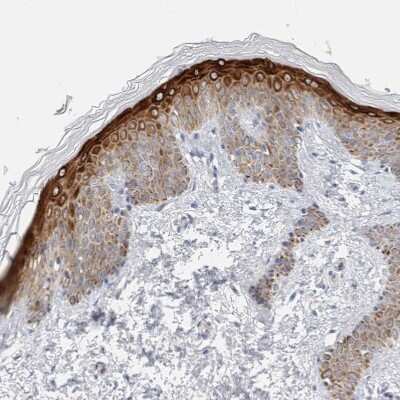 Immunohistochemistry-Paraffin: SDR16C5 Antibody [NBP1-87150]