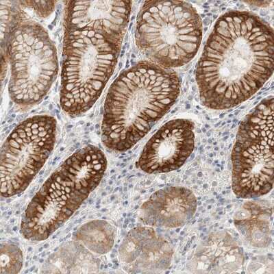 Immunohistochemistry-Paraffin: SDR16C5 Antibody [NBP1-87150]