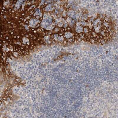 Immunohistochemistry-Paraffin: SDR16C5 Antibody [NBP1-87150]