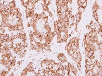 Immunohistochemistry-Paraffin: SDR16C5 Antibody [NBP2-20277]