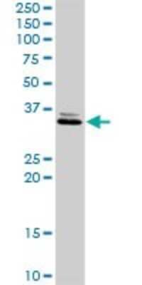 Western Blot: SDR16C5 Antibody [H00195814-D01P]