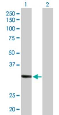Western Blot: SDR16C5 Antibody [H00195814-D01P]