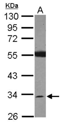 Western Blot: SDR16C5 Antibody [NBP2-20277]