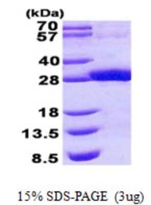 SDS-PAGE: Recombinant Human SDR16C5 His Protein [NBP2-23469]