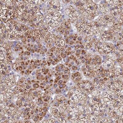 Immunohistochemistry-Paraffin: SDR39U1 Antibody [NBP1-92373]