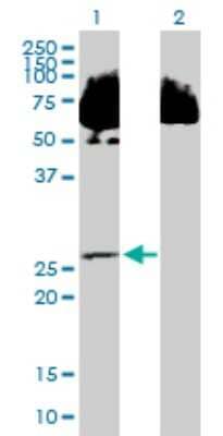 Western Blot: SDR39U1 Antibody [H00056948-B01P]