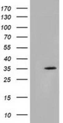 Western Blot: SDR9C7 Antibody (OTI4B5) [NBP2-03030]