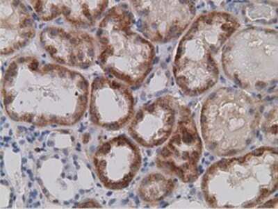 Immunohistochemistry: SDR9C7 Antibody (OTI4B5) - Azide and BSA Free [NBP2-74036]