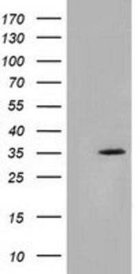 Western Blot: SDR9C7 Antibody (OTI4B5)Azide and BSA Free [NBP2-74036]