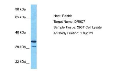 Western Blot: SDR9C7 Antibody [NBP2-84256]