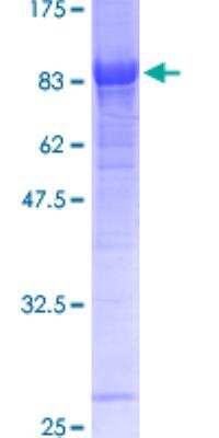 Other: Recombinant Human GAD2/GAD65 GST (N-Term) Protein [H00002572-P03]