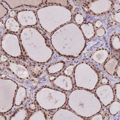 Immunohistochemistry-Paraffin: SDS3 Antibody [NBP2-48751]