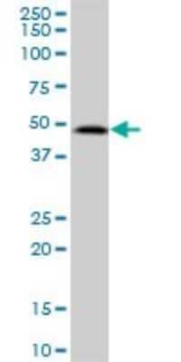 Western Blot: SDS3 Antibody [H00064426-B01P]